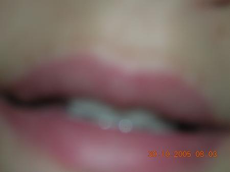 bisous