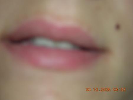 bisous